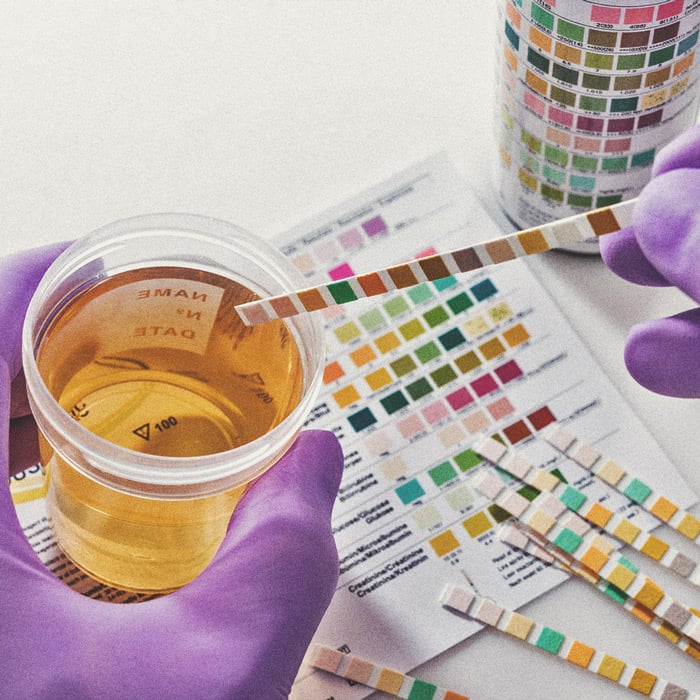 Laat een Drugstest Zien of Je Passief Wiet Hebt Gerookt? Laat een Drugstest Zien of Je Passief Wiet Hebt Gerookt?
