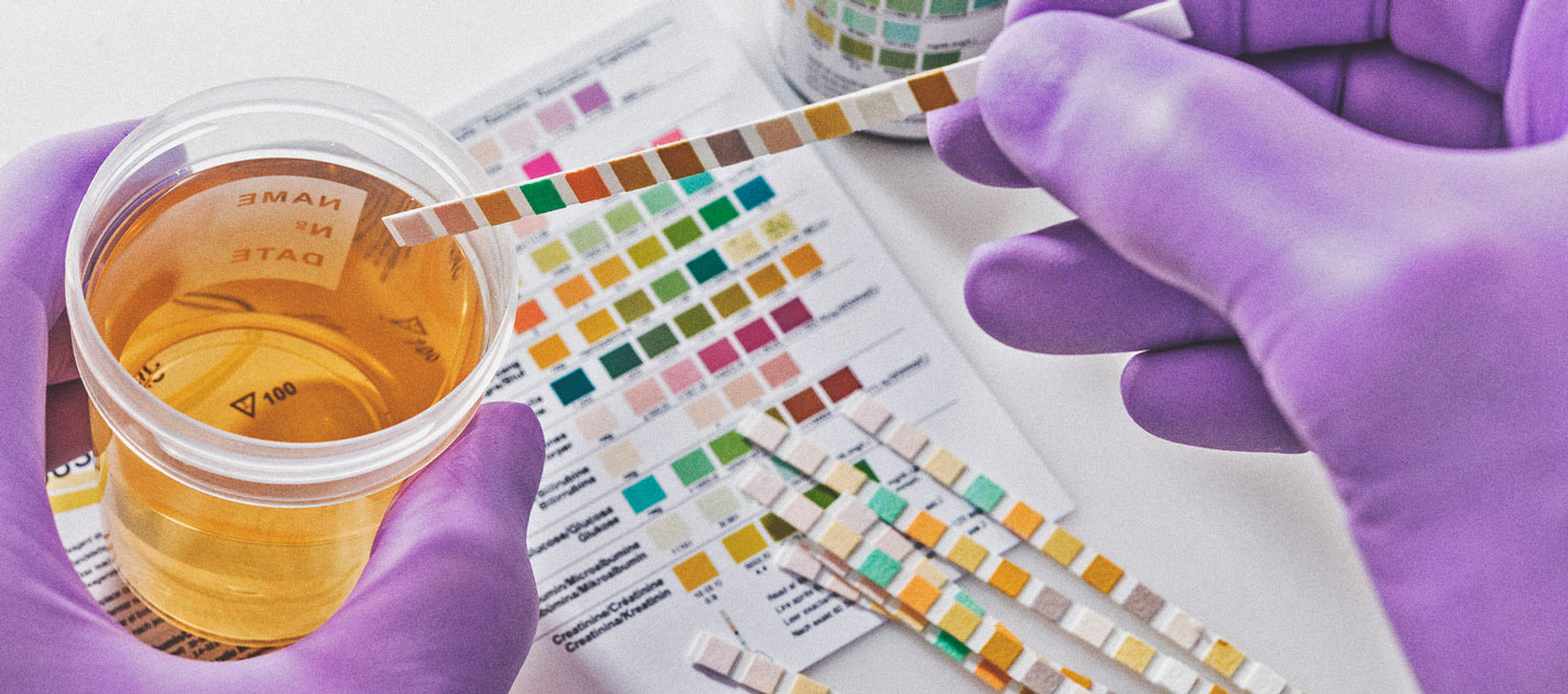 Laat een Drugstest Zien of Je Passief Wiet Hebt Gerookt? Laat een Drugstest Zien of Je Passief Wiet Hebt Gerookt?