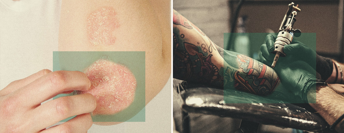 Hoe maak je cannabis lotions? — cannabis topicals 101 Hoe maak je cannabis lotions? — cannabis topicals 101