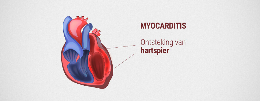 Myocarditis Myocarditis