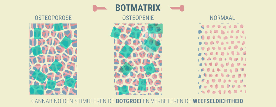 Osteoporose CBD