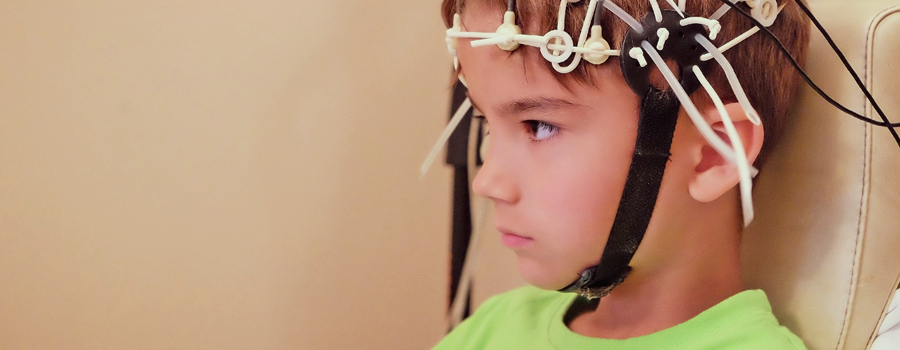 Kinder epilepsie Dravet syndroom