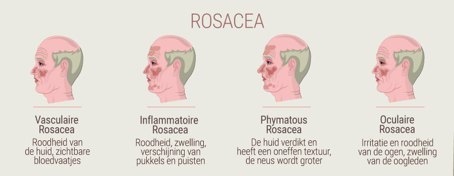 Rosacea Rosacea