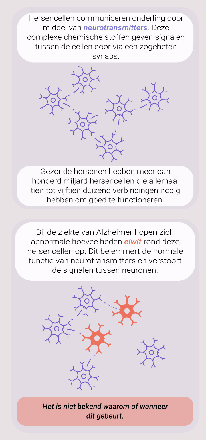 What Causes Alzheimer What Causes Alzheimer