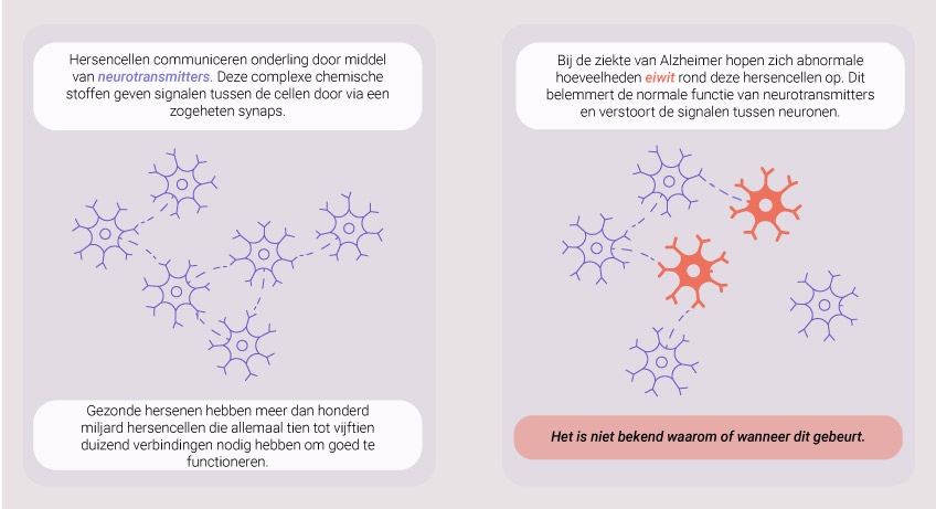 What Causes Alzheimer What Causes Alzheimer