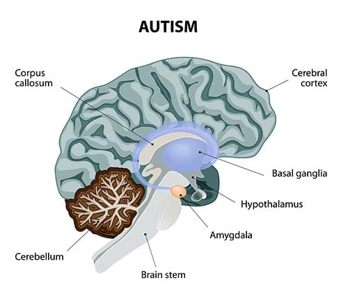 cannabis autisme