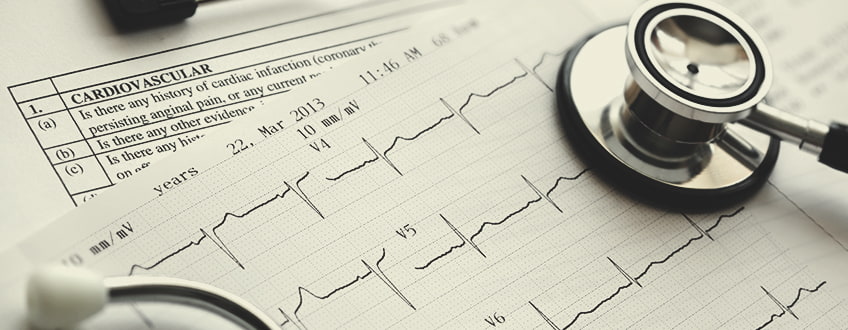 CBD en de cardiovasculaire gezondheid