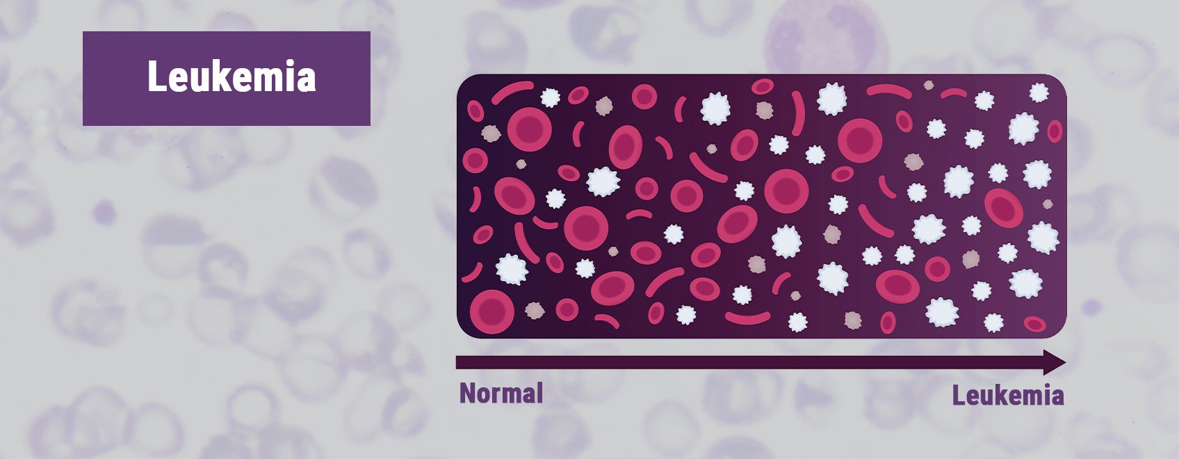 Leukemie