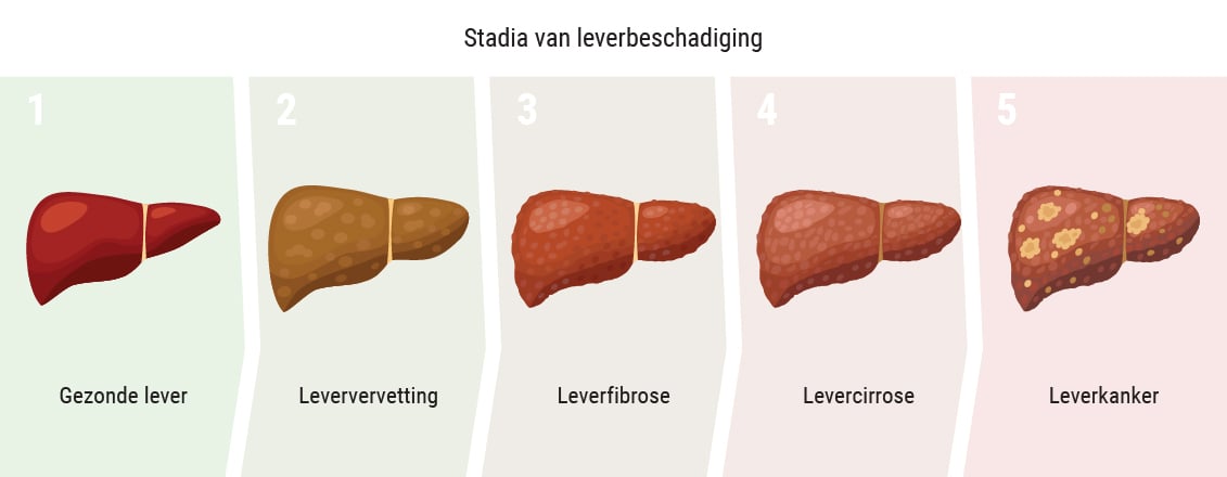 Beïnvloedt wiet de lever?