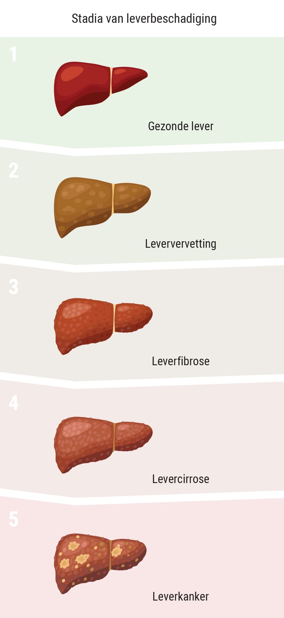 Beïnvloedt wiet de lever? Beïnvloedt wiet de lever?