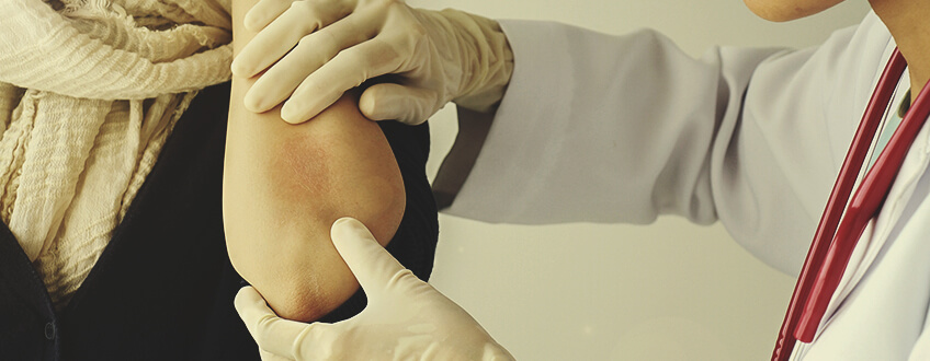 Welk Type CBD Werkt het Best bij de Behandeling van Psoriasis? Welk Type CBD Werkt het Best bij de Behandeling van Psoriasis?