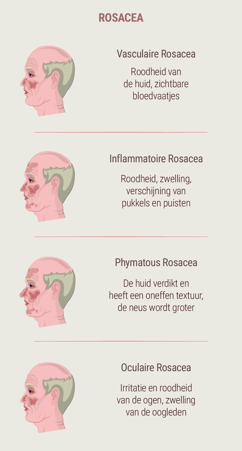 Wat is rosacea? Wat is rosacea?
