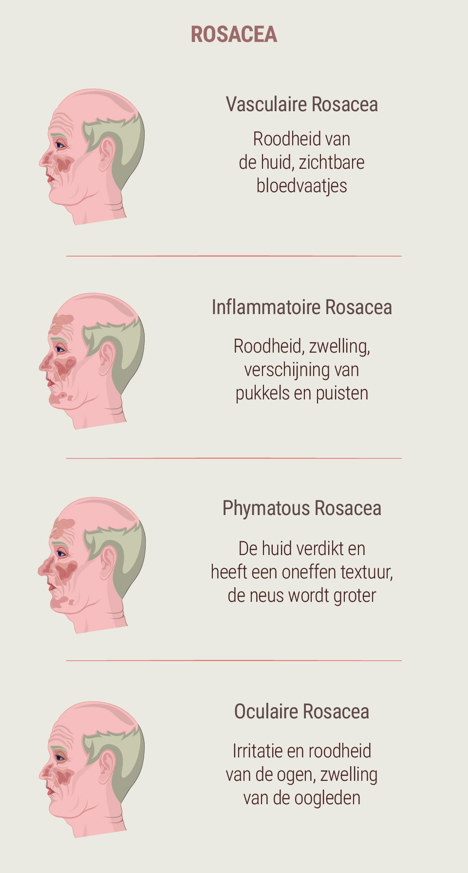 Wat is rosacea?