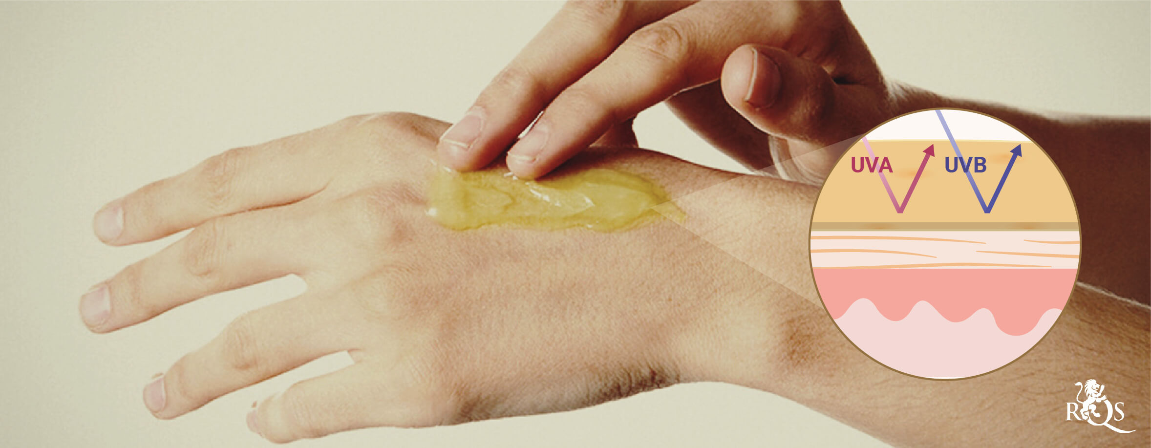 Helpt CBD-lotion tegen Zonnebrand? Helpt CBD-lotion tegen Zonnebrand?
