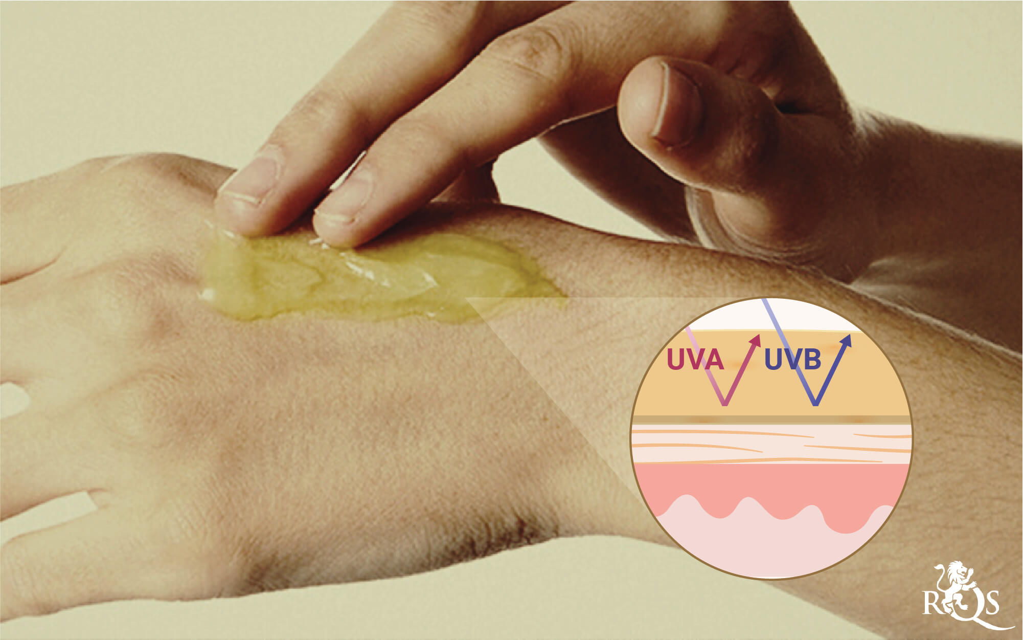 Helpt CBD-lotion tegen Zonnebrand? Helpt CBD-lotion tegen Zonnebrand?