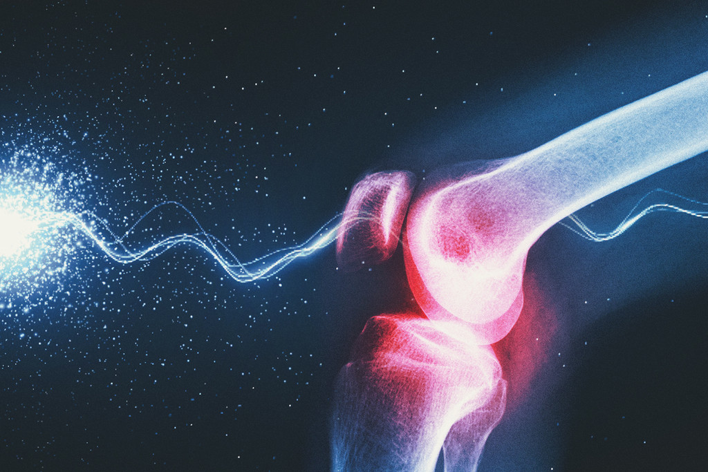 Kan wiet de pijn en ontstekingen bij artritis verminderen?